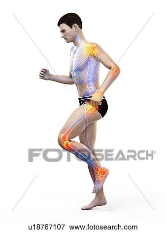 Stock Photo - Joint pain, conceptual illustration.. Fotosearch