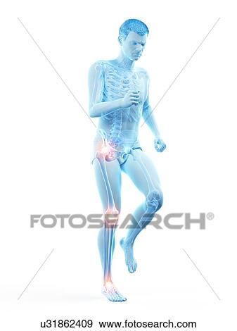 Stock Photo - Joint pain, conceptual illustration.. Fotosearch