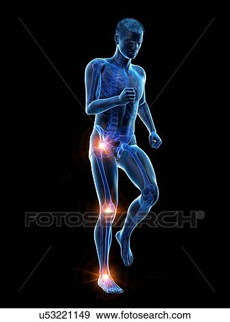 Joint pain, conceptual illustration. View Large Photo Image Stock Photo - Joint pain, conceptual illustration.. Fotosearch