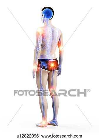 Joint pain, conceptual illustration. View Large Photo Image Stock Photograph - Joint pain, conceptual illustration.. Fotosearch