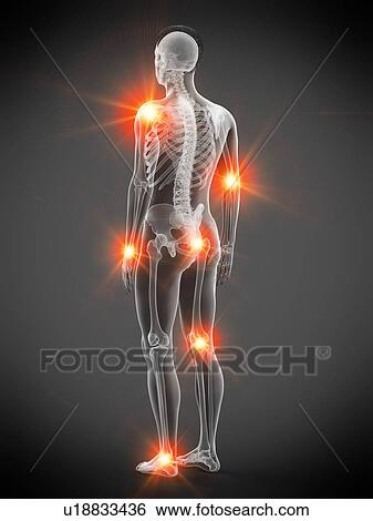 Joint pain, conceptual illustration. View Large Photo Image Stock Photograph - Joint pain, conceptual illustration.. Fotosearch