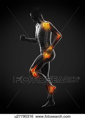 Stock Photograph - Joint pain, conceptual illustration.. Fotosearch