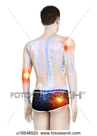 Stock Photography - Joint pain, conceptual illustration.. Fotosearch