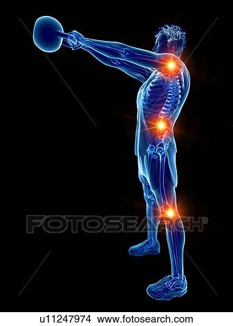 Picture - Joint pain during kettlebell workout, conceptual computer illustration.. Fotosearch