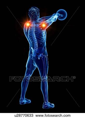 Stock Image - Joint pain during kettlebell workout, conceptual computer illustration.. Fotosearch