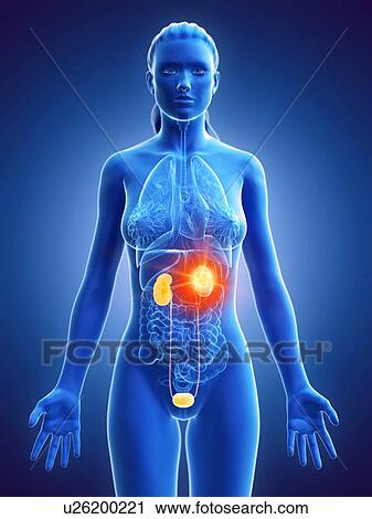 Kidney cancer, conceptual computer illustration. View Large Photo Image Stock Image - Kidney cancer, conceptual computer illustration.. Fotosearch