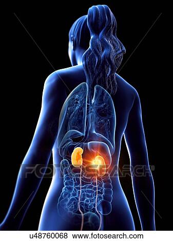 Kidney cancer, conceptual computer illustration. View Large Photo Image Stock Photo - Kidney cancer, conceptual computer illustration.. Fotosearch