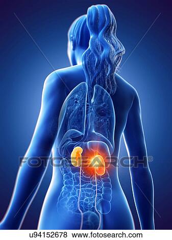 Kidney cancer, conceptual computer illustration. View Large Photo Image Stock Photo - Kidney cancer, conceptual computer illustration.. Fotosearch