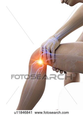 Stock Image - Knee pain, conceptual illustration.. Fotosearch