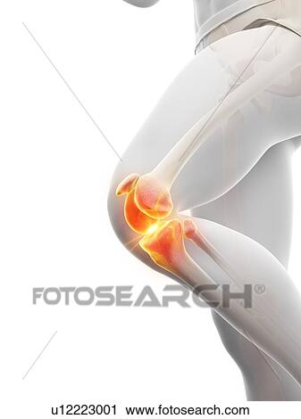 knee pain, conceptual illustration. View Large Photo Image Stock Image - knee pain, conceptual illustration.. Fotosearch