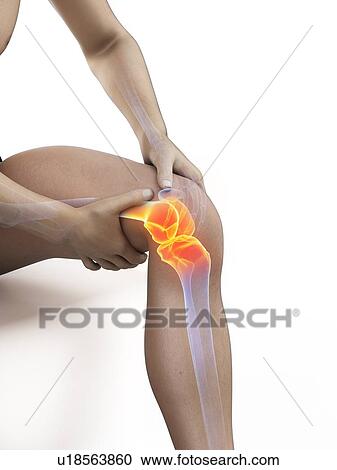 Knee pain, conceptual illustration. View Large Photo Image Stock Image - Knee pain, conceptual illustration.. Fotosearch