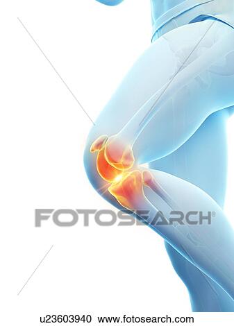 Stock Image - knee pain, conceptual illustration.. Fotosearch