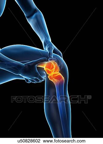 Stock Image - Knee pain, conceptual illustration.. Fotosearch
