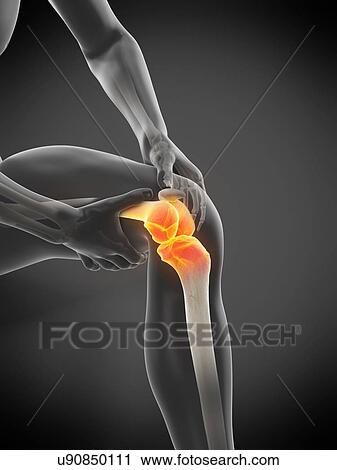 Stock Image - Knee pain, conceptual illustration.. Fotosearch