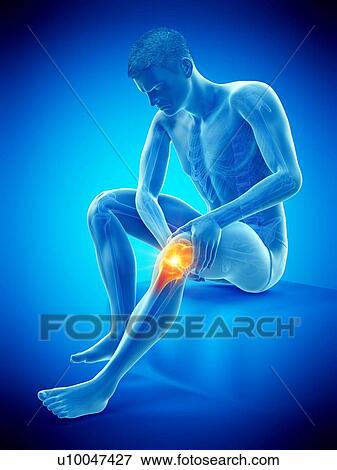 Stock Photo - Knee pain, conceptual illustration.. Fotosearch
