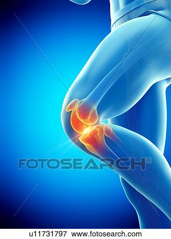knee pain, conceptual illustration. View Large Photo Image Stock Photo - knee pain, conceptual illustration.. Fotosearch