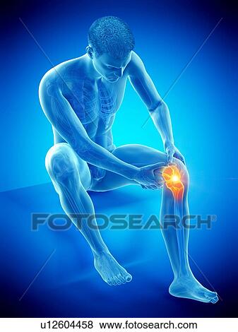 Knee pain, conceptual illustration. View Large Photo Image Stock Photo - Knee pain, conceptual illustration.. Fotosearch