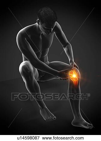 Stock Photo - Knee pain, conceptual illustration.. Fotosearch