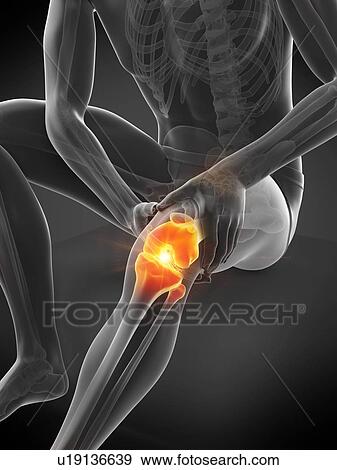 Knee pain, conceptual illustration. View Large Photo Image Stock Photo - Knee pain, conceptual illustration.. Fotosearch
