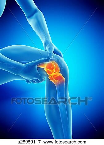 Stock Photo - Knee pain, conceptual illustration.. Fotosearch