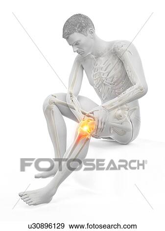 Stock Photo - Knee pain, conceptual illustration.. Fotosearch