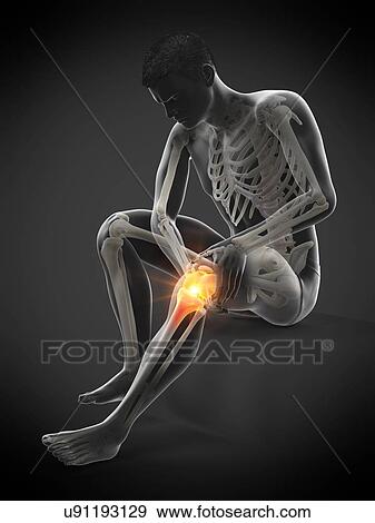 Stock Photo - Knee pain, conceptual illustration.. Fotosearch