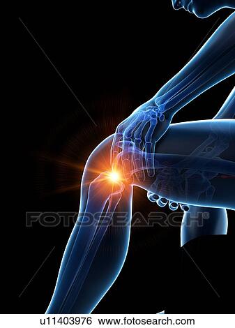 Knee pain, conceptual illustration. View Large Photo Image Stock Photograph - Knee pain, conceptual illustration.. Fotosearch