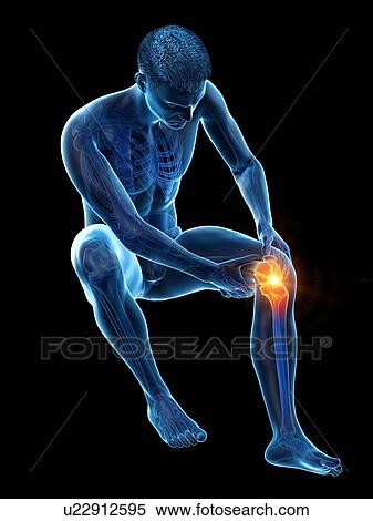 Stock Photography - Knee pain, conceptual illustration.. Fotosearch