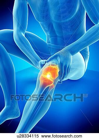 Knee pain, conceptual illustration. View Large Photo Image Stock Photography - Knee pain, conceptual illustration.. Fotosearch