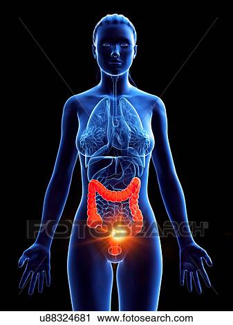 Large intestine, computer illustration. cancer View Large Photo Image Stock Image - Large intestine, computer illustration. cancer. Fotosearch