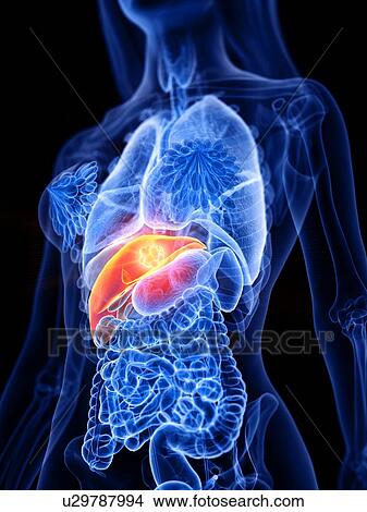 Liver cancer, conceptual illustration View Large Photo Image Picture - Liver cancer, conceptual illustration. Fotosearch