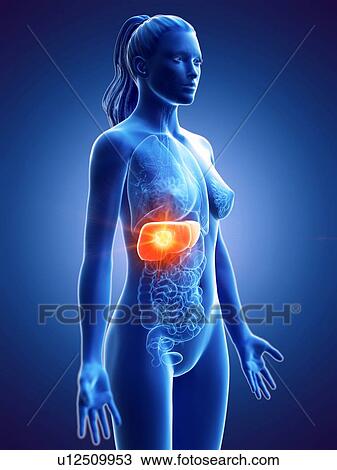 Stock Image - Liver, computer illustration. cancer. Fotosearch