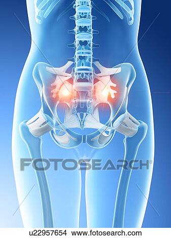 Lower back pain, conceptual computer illustration. View Large Photo Image Picture - Lower back pain, conceptual computer illustration.. Fotosearch