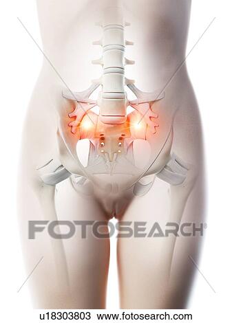 Stock Image - Lower back pain, conceptual computer illustration.. Fotosearch
