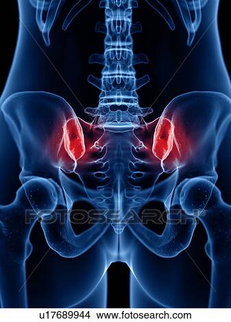 Lower back pain, conceptual illustration View Large Photo Image Picture - Lower back pain, conceptual illustration. Fotosearch