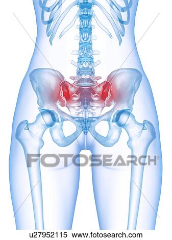 Stock Photography - Lower back pain, conceptual illustration. Fotosearch