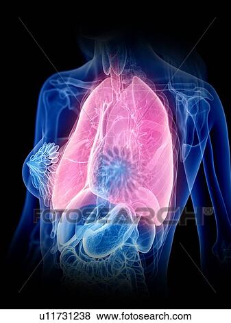 Stock Photo - Lungs, illustration. Fotosearch