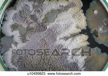 Stock Image - Microbial colonies on petri dish.. Fotosearch