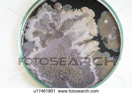 Microbial colonies on petri dish. View Large Photo Image Stock Image - Microbial colonies on petri dish.. Fotosearch