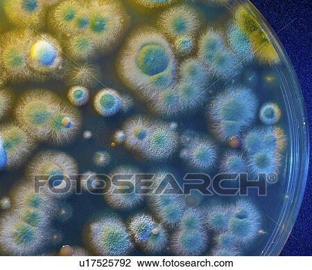 Stock Image - Microbial colonies on petri dish.. Fotosearch