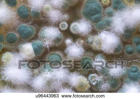 Microbial colonies on petri dish. View Large Photo Image Stock Image - Microbial colonies on petri dish.. Fotosearch