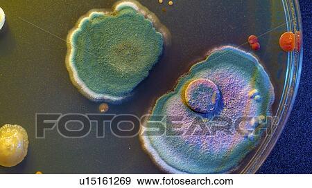 Stock Photo - Microbial colonies on petri dish.. Fotosearch