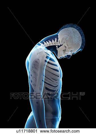 Stock Image - Neck anatomy, illustration.. Fotosearch