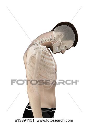 Neck anatomy, illustration. View Large Photo Image Stock Image - Neck anatomy, illustration.. Fotosearch