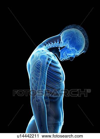 Stock Image - Neck anatomy, illustration.. Fotosearch