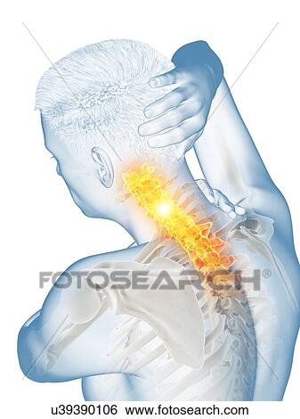 Neck pain, conceptual illustration. View Large Photo Image Stock Photograph - Neck pain, conceptual illustration.. Fotosearch