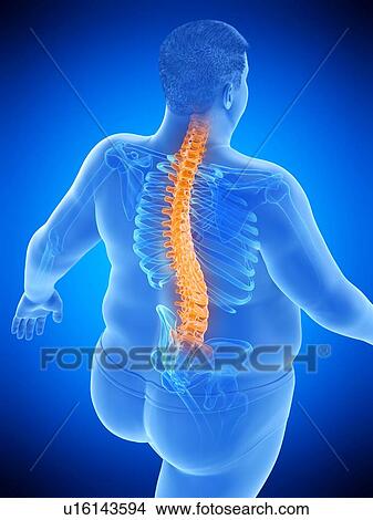 Picture - Obese man with back pain, computer illustration.. Fotosearch