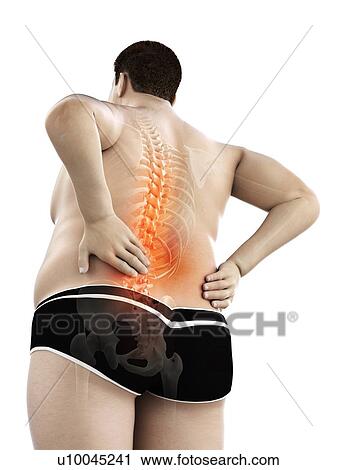 Stock Image - Obese man with back pain, computer illustration.. Fotosearch