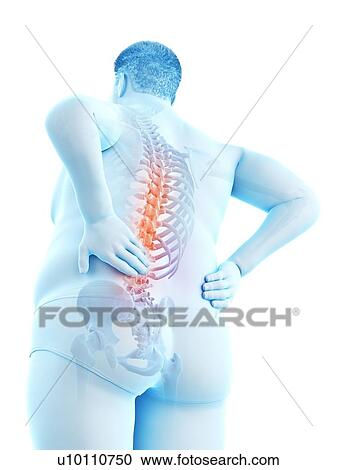 Obese man with back pain, computer illustration. View Large Photo Image Stock Image - Obese man with back pain, computer illustration.. Fotosearch