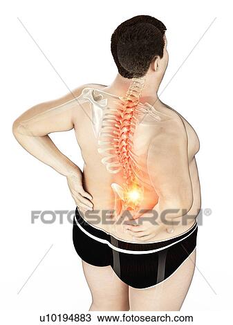 Stock Image - Obese man with back pain, computer illustration.. Fotosearch